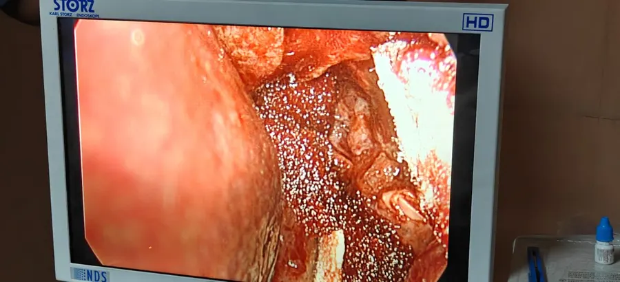 Karl Storz HD endoscopic system